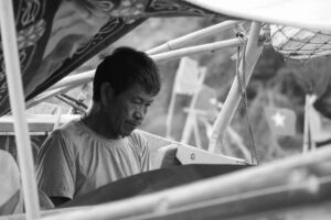 大人ニキビとたるみを改善するイソトレチノインの効果とは？