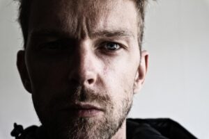 40代の大人ニキビに効果的な化粧水はどれ？